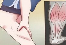 GRČEVI U NOGAMA SU OPASAN SIMPTOM: Evo na šta ukazuje bol u listovima i butinama!