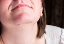 Znate li zašto ženama rastu dlake na bradi? To vam vaše tijelo govori