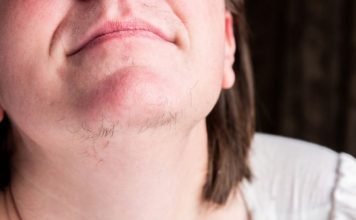 Znate li zašto ženama rastu dlake na bradi? To vam vaše tijelo govori