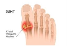 Evo tri narodna lijeka za giht kojima je cilj eliminirati mokraćnu kiselinu iz tijela, što predstavlja potencijalno rješenje za one koji traže olakšanje.