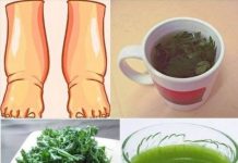 NAJMOĆNIJE prirodno sredstvo protiv OTICANJA NOGU