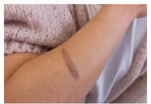 NIKAD NE STAVLJAJTE LED NA OPEKOTINU: Kako da ublažite bol i vrelinu na mjestu povrede