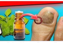 Gljivice i infekcija noktiju NESTAJU za 24 sata: Volio bih da sam znao za ovo ranije!