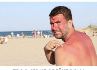 ZBOG JEDNE GREŠKE BOLI I NASTAJU PLIKOVI: Ako izgorite na suncu, dva sastojka su spas, ali samo ako ih ovako mažete