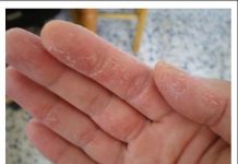 PUCANJE KOŽE, TRNCI ILI OPADANJE KOSE SU PRVI ZNAKOVI: Evo šta vam tijelo govori!