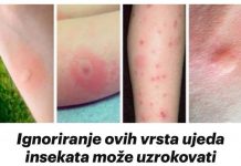 Ignoriranje ovih vrsta ujeda insekata može uzrokovati nepovratne komplikacije: Ako primijetite ove simptome, ODMAH POZOVITE LJEKARA