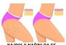 NAJBOLJI NAČIN DA SE PRIRIDNO RIJEŠITE CELULITA: Zaboravite na masaže i skupe tretmane, ovako ćete ga “ISPEGLATI” ZAUVIJEK