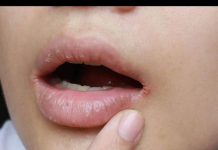 OTKRIJTE NEDOSTATAK VITAMINA: ZNAKOVI KOJE VAŠE TIJELO ŠALJE