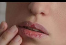 NEDOSTATAK ŽELJEZA U KRVI: 6 neobičnih simptoma koji mogu ukazati na ANEMIJU