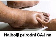 Najbolji prirodni ČAJ na svijetu za uklanjanje OTEKLINA!