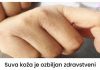 Suva koža je ozbiljan zdravstveni simptom koji mnogi ljudi ignoriraju: OVAJ BOLESNI ORGAN VAPI ZA POMOĆ!