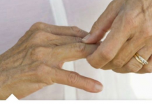 OVA HRANA JE LOŠA ZA VAŠE KOSTI: Utiče na razvoj artritisa i loše zglobove!