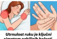Utrnulost Ruku Je Ključni Smptom 0zbiljnih Bolesti. 97% Ljudi Ignorira Ovo Upozorenje-U OVOJ FAZI 0BRATITE SE LJEKARU
