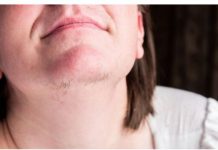 EVO ZAŠTO ŽENE IMAJU DLAKAVU BRADU! Ovo vam organizam govori!