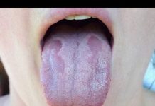 ZAUVIJEK SE RIJEŠITE KANDIDE: Ovaj recept se rješava ove opasne gljivice!