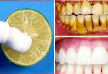Za samo dva minuta – Prirodno izbjelite zube ovom metodom