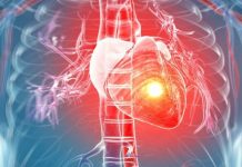 Ako imate aritmiju ovih 7 stvari morate da znate: Zašto se javlja i kako se leči?