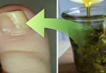 “RAZBIJAČ GLJIVICA”: Riješite se gljivičnih infekcija vrlo BRZO i EFIKASNO!