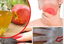 OVO SVI IMAMO U KUĆI: Rješava upalu grla, perut, uklanja bradavice i akne! (VIDEO)