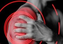 Da li vam često B0L “pada” s ramena i na ruke? Hirurg objašnjava stanje i da li je opasno