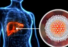 MNOGI I NE SANJAJU DA IMAJU OVO OBOLJENJE Hepatitis C dugo ne daje simptome a ostavlja teške posledice, zato je dobro obaviti sledeće kontrole