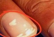 NISAM MOGLA DA UKLONIM GLJIVICE S NOKTIJU, sve dok nisam namazala OVO!