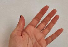 Osjećate li trnce u rukama ili prstima? To je ono na što vas ovaj simptom upozorava