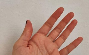 Osjećate li trnce u rukama ili prstima? To je ono na što vas ovaj simptom upozorava