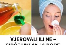 Vjerovali ili ne – sirće se može riješiti bora, akni i staračkih pjega
