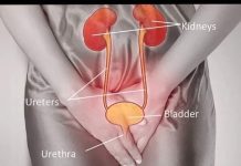 Savjet ljekara: Šta učiniti kada patite od učestalog mokrenja, bolnog mokrenja i hitnosti