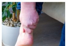 3 ZNAKA VISOKOG HOLESTEROLA: Odmah pogledajte vaše ruke i noge