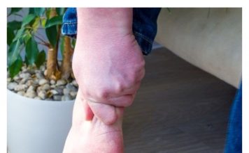 3 ZNAKA VISOKOG HOLESTEROLA: Odmah pogledajte vaše ruke i noge