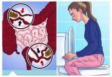 Danima niste bili na WC-u, muči vas kronični zatvor u stolici i osjećate se kao da ćete eksplodirati: evo kako ga se riješiti!