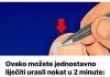 Ovako možete jednostavno liječiti urasli nokat u 2 minute: Ovaj bezbolni postupak štedi vam posjet liječniku. SVAKO TO MOŽE