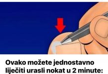 Ovako možete jednostavno liječiti urasli nokat u 2 minute: Ovaj bezbolni postupak štedi vam posjet liječniku. SVAKO TO MOŽE