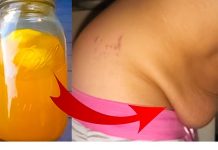 ZABORAVITE NA VISEĆI STOMAK: Uklonite ga ovim snažnim prirodnim lijekom za samo 10 dana!