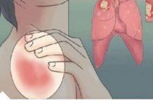 EVO KAKO MOŽETE PROVJERITI DA LI IMATE SLAB IMUNITET: 6 Znakova Lošeg Imuniteta, Ovako Tijelo Upozorava