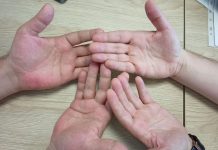 Svrbi vas dlan, mislite da su pare, ko god je to rekao slagao vas je – evo šta znači ako svrbi lijevi ili desni dlan