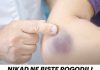 NIKAD NE BISTE POGODILI ZAŠTO SE MODRICE JAVLJAJU PO TIJELU: Nema Veze Sa POVREDAMA, PRAVI RAZLOG ĆE VAS ŠOKIRATI