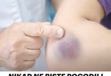 NIKAD NE BISTE POGODILI ZAŠTO SE MODRICE JAVLJAJU PO TIJELU: Nema Veze Sa POVREDAMA, PRAVI RAZLOG ĆE VAS ŠOKIRATI