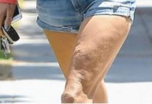 10 IZNENAĐUJUĆIH NAČINA KAKO ISKORISTITI JABUČNI OCAT U SVAKODNEVNOM ŽIVOTU