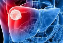 OVO SU SIMPTOMI DA IMATE BOLESNU JETRU: Evo kada trebate kod ljekara – NE ČEKAJTE SUTRA