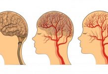 Hrani mozak i čuva pamćenje, JEDITE JE JEDNOM SEDMIČNO – NAJBOLJA NAMIRNICA PROTIV DEMENCIJE, MNOGI JE RIJETKO KAD JEDU!