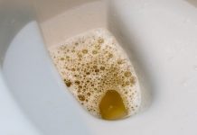 OVO JE SIMPTOM VISOKOG NIVOA ŠEĆERA: Primjetićete ga u urinu, obratite pažnju!