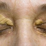 37004_shutterstock-1108460534-1_f