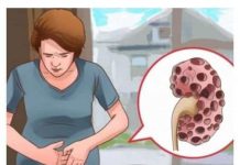 KADA SA BUBREZIMA NIJE SVE UREDU TIJELO ŠALJE OVE SIGNALE