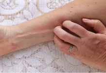 Simpt0mi DIJABETESA koji se javljaju i prije njegovog početka! 9 signala koje nikada ne biste trebali zanemariti…