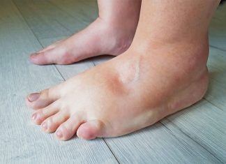 DOBRO POGLEDAJTE NOGE: Jedan simptom ukazuje na problem sa srcem, a mnogi ga ignorišu