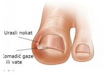 NAJBOLJI SAVJET ZA URASTAO NOKAT: Promjenu ćete osjetiti za nekoliko minuta, a djeluje i protiv modrica i gljivica!