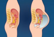 Ovo povrće može izazvati nadutost i plinove: izbjegavajte ovu namirnicu ako želite ravan trbuh